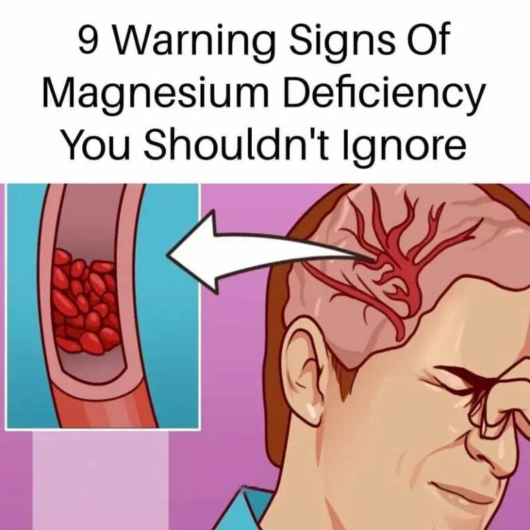 9 Signs of Magnesium Deficiency You Should Know. Read full story in