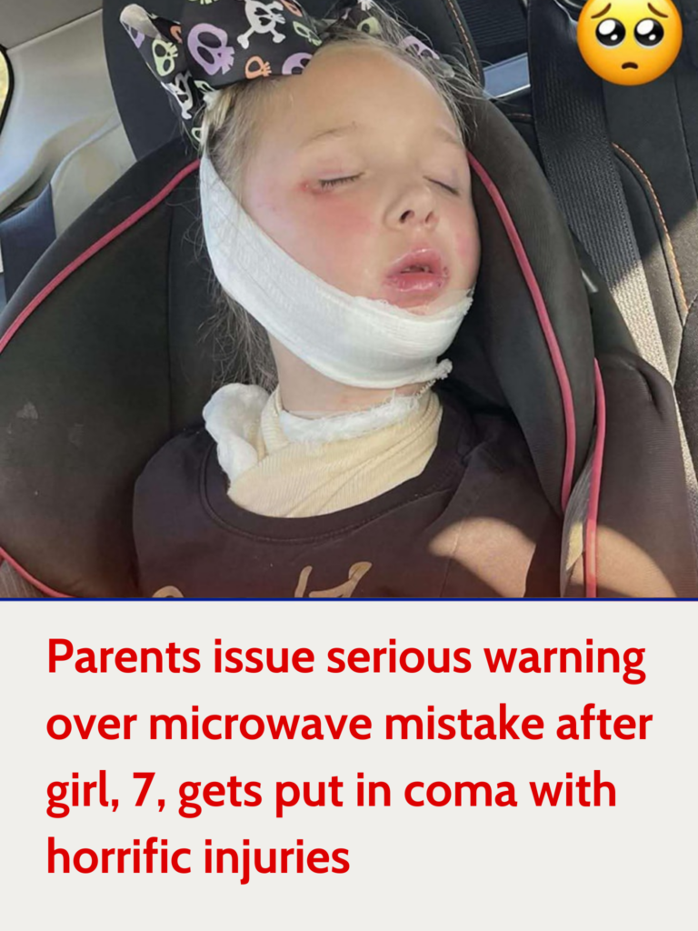 Parents warn of fatal microwave mistake after 7-year-old girl suffers severe injuries and falls into a coma