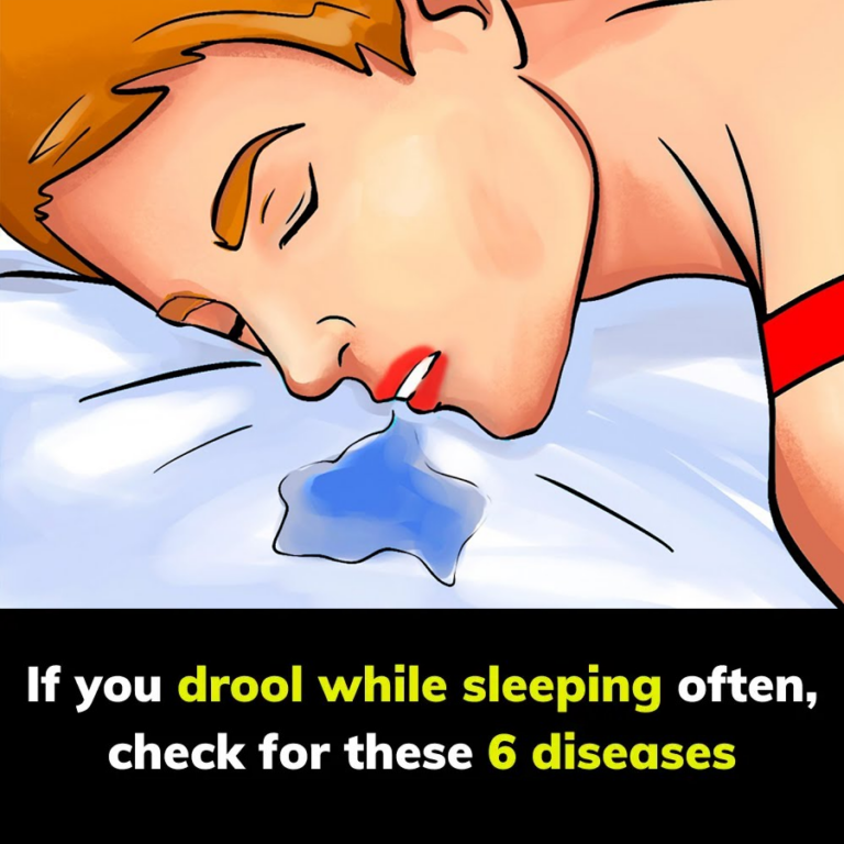 Drooling while sleeping should not be ignored, as it could indicate certain health issues.