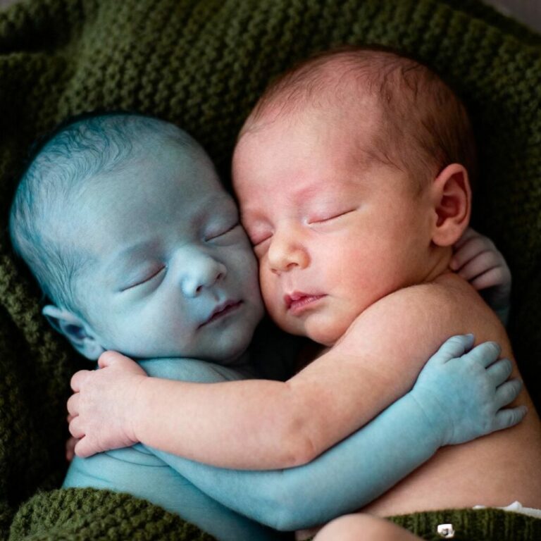 When the nurse placed the lifeless baby beside her healthy twin, she only hoped to say goodbye. But what happened next made her fall to her knees in tears…